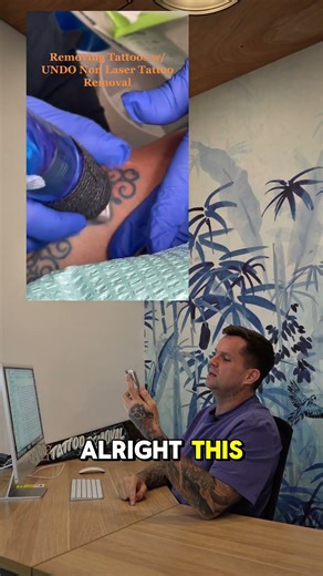 Tattoo Removal Laser FAIL