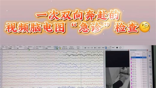 #癫痫 #医学科普 未来，视频脑电图的“急诊”评估是一个重要方向‼️纪实一例超长程视频脑电图的全流程检查‼️
