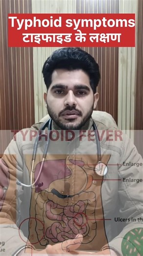 Symptoms of Typhoid fever।