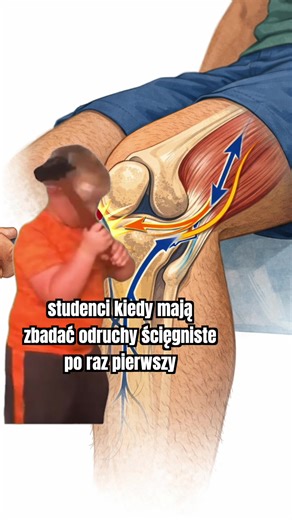 Po co Fizjo odruchy ścięgniste? 💃🏻 Fizjoterapeuta bardzo często jest pierwszym specjalistą, do którego trafia pacjent z bólem kręgosłupa. Dlatego badanie odruchów ścięgnistych jest tak istotne. To szybki i czuły wskaźnik funkcjonowania obwodowego i ośrodkowego układu nerwowego. Proste uderzenie młotkiem w ścięgno daje informację o przewodnictwie w całym łuku odruchowym – od receptora w mięśniu, przez korzeń nerwowy i rdzeń kręgowy, aż do włókien ruchowych wracających do mięśnia. Odruchy mogą b