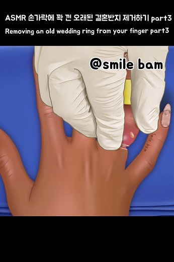 #smilebam #애니메이션 #asmr #care ##satisfying #soonent #fingernail #ring