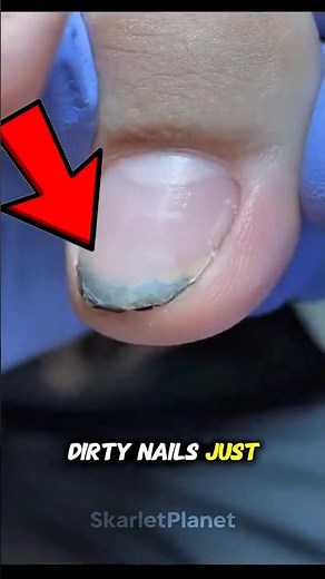 What’s REALLY Under Your Fingernails? 🤢🔍 #microscope #nails