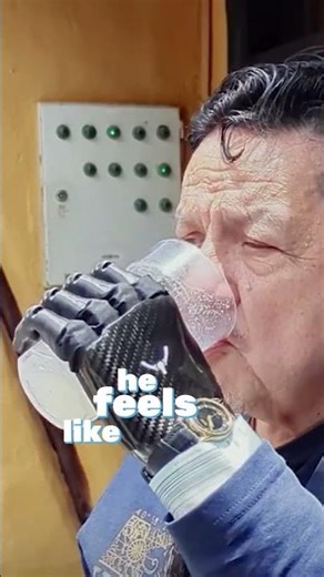 “I Feel Like Robocop” Redefining Pride Through a Bionic Hand, PSYONIC