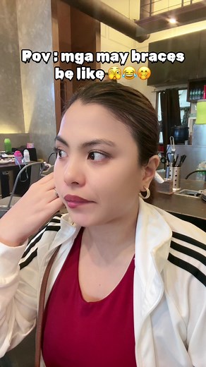 Braces Comedy Compilation: Pov of Braces Wearers 😂🫣