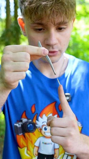Jak Bezpečně Odstranit Třísku?
