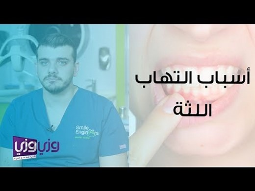 أسباب التهاب اللثة