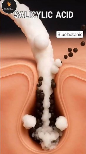 How Salicylic Acid Works #shrots #viral
