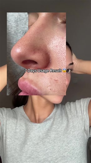 Achieve Glass Skin with Medicube Products