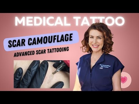 How Scar Camouflage helps with Self Harm Scars