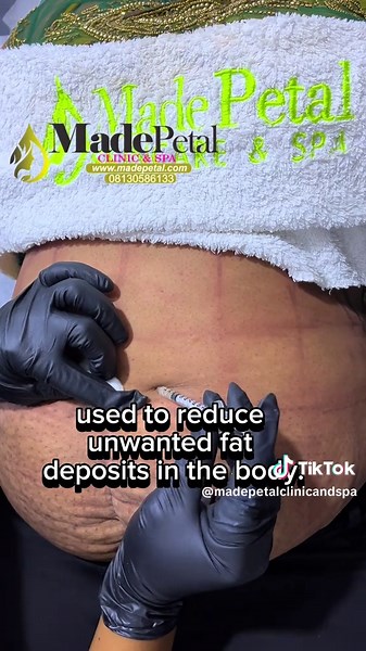 Tummy reduction #tummytuck #tummytime #tummycontrol #tummytucksurgery #tummyreduction #tummyreductionproductsinlagos #tummyreductionproductsinnigeria #tummyreductioninibadan