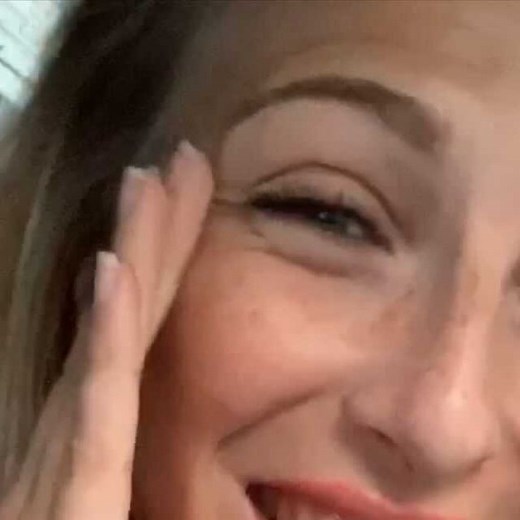 Julie Bourges (DouzeFevrier) on Instagram: "J’ai retrouvé ma bouche d’avant l’accident… ❤️ Parce-que quoi qu’on en dise… Parfois l’acceptation ne passe pas juste par le fait de le VOULOIR ou de DÉCONSTRUIRE. Parfois on sent, au plus profond de nous, qu’on ne pourra pas. Parce-que quand on se regarde, on sait ce que c’était… ou ce que ça aurait pu être si les choses s’étaient déroulées différemment. J’ai décidé de faire tatouer médicalement la cicatrice qu’avait laissé le feu sur ma bouche. Laiss