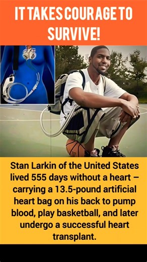 stan larkin lived without heart ❤️ #viral #news #shorts #trending