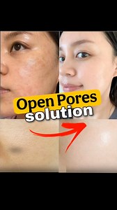 2.1M views · 22K reactions | Tammna Bhatia skin care secret revea. l#openpores #openporessolution #skin #skincareroutine #skincare #homeremedy #tammnabhatia #trending #viral #viralreels. {open pores, open pores solution, skin care, skin problem, open pores problems, pimple, acne, dark spot, pigmentation, home remedies, home remedy, skin care routine, viral video, viral reel, trending video, trending reel, explore} | Thefocasual | Facebook