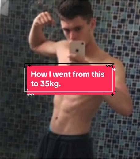 My stoma story Part 1. #stoma #edutokmotivation #stomaawareness #ibd #inflammatoryboweldisease #colitis #crohnsdisease #edutok #ileostomy #lifewithastoma #stomabagsavedmylife #europe #life @Crohn’s & Colitis UK @Salts Healthcare @NHS UK