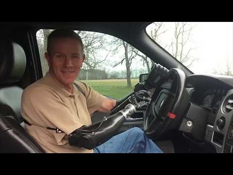 Driving with Two Prosthetic Arms