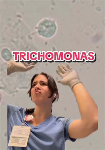 Trichomonas vaginalis #medtech #medtechtok #lab #wetprep #cls | trichomonas
