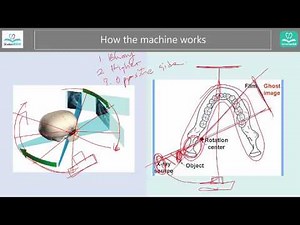 Panoramic radiographs - Ghost image, charateristics [SIMPLE]