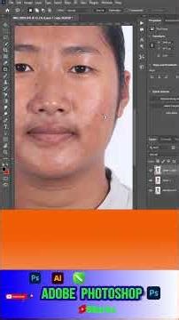 Remove pimple in 10 sec #photoshop #sorts #Remove