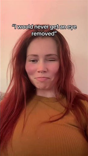 My ocularist’s work is so good that it’s mistaken for AI constantly