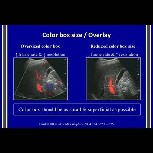 6.3K views · 72 reactions | Portal Vein Doppler by Samir Haffar | John Z Wetmore | Facebook