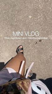 Iavintsoa Rajaonarison on Instagram: "Marre d’essayer toutes sortes de produits cosmétiques — J’ai testé l’électrocoagulation pour enlever toutes mes taches pigmentaires sur le visage et le cou ! ✨ Je vous montre tout dans ce mini-vlog, du avant/après et l’évolution jour après jour. Alors, ça vaut le coup ou pas ? Je dirais même, si c’était à refaire je le referai !! PS : Si vous envisagez de tester, protégez VRAIMENT votre peau du soleil et évitez toute exposition directe, c’est important pour