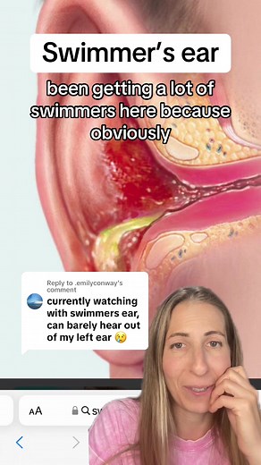 Understanding Swimmer’s Ear: Symptoms, Causes, and Treatment