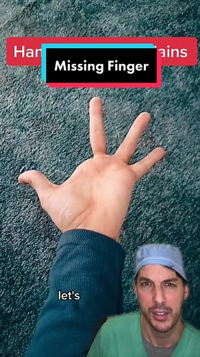 #duet with @talentedsoul #missingfinger Missing finger explained #MissingFinger #Finger #FingerChallenge #FingerTrick #Trick #Magic #handchallenge