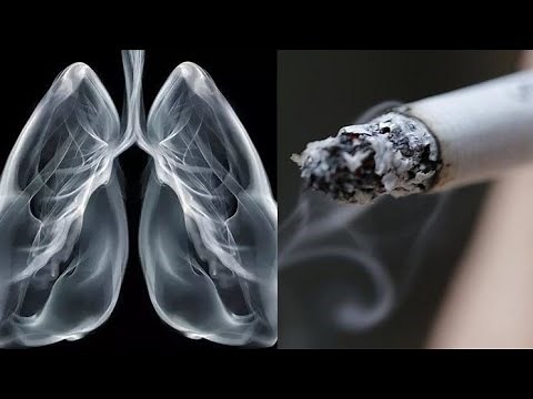 How Cigarette Smoking Damages our Lungs?