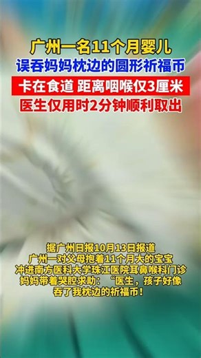 🤍 广州一名11个月婴儿误吞妈妈枕边的圆形祈福币 🤍