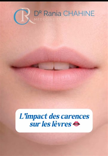 👄 L’impact de certaines carences sur l’apparence des lèvres Les lèvres sont une zone particulièrement sensible. Leur peau est fine, fragile et pauvre en glandes sébacées, ce qui les rend plus vulnérables à la sécheresse et aux irritations. Dans certains cas, leur apparence peut aussi être influencée par l’hydratation et l’équilibre nutritionnel. Certaines carences, notamment en zinc, vitamines du groupe B ou protéines, peuvent s’accompagner de modifications comme : • sécheresse importante • fis