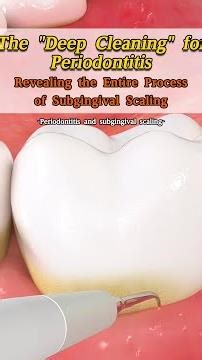 Periodontitis doesn't equal inflammation! Subgingival scaling is the real solution