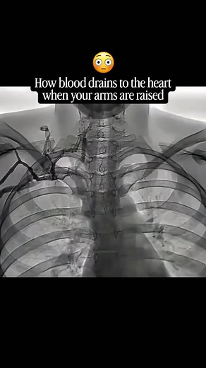 233K views · 371 reactions | 變 The human body is pretty amazing....
