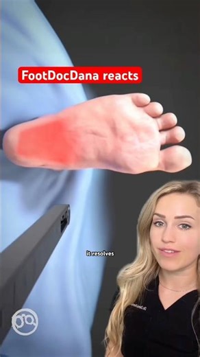 Doctor explains: plantar fasciitis surgery