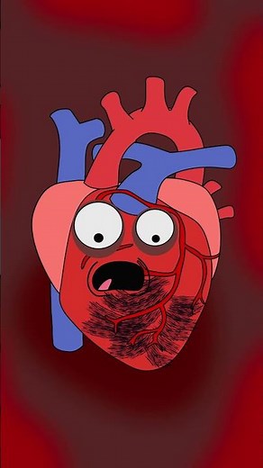 STEMI Explained in 30s | ST Elevation Pathophysiology for USMLE Step 1 & Step 2