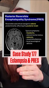 1.8K reactions · 99 comments | Case Study 177 - Eclampsia and...