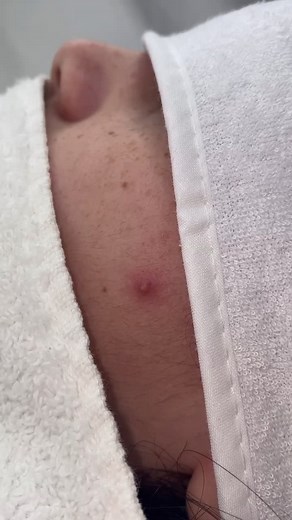 Pop goes the cheek 🌋 #fyp #NespressoTalents #cheek #viral