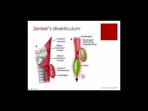 #e207 Preview: GERD & LPR in Adults - The SLPs Role in Diagnosis & Treatment