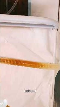 Why stress can give you an upset tummy (and what to do about it)