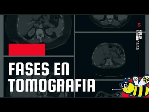 🔴⚫Fases en tomografía, las conoces todas? las sabes identificar y su utilidad?🔴⚫