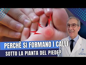 Perchè si formano i calli sotto la pianta del piede? | Dott. Andrea Scala