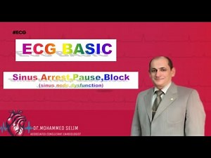 22 -Sick Sinus Syndrome