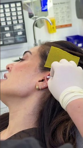 Precision and Style: The Forward Helix #forwardhelix #helixpiercing #daithpiercing #nosepiercing