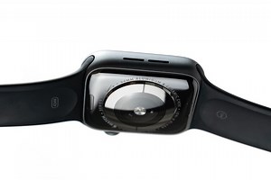 La medición de azúcar en sangre es el santo grial de los smartwatches: así está la carrera de Samsung y Apple contra la diabetes