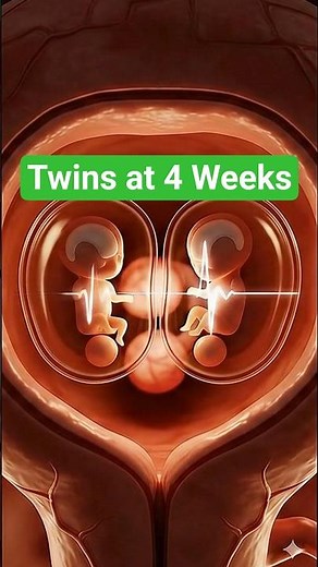 Twin Babies at 4 Weeks in the Womb 🍼 | Early Pregnancy Growth Explained #twinmoments