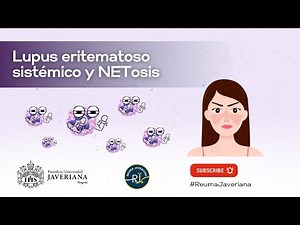 Lupus eritematoso sistémico y NETosis