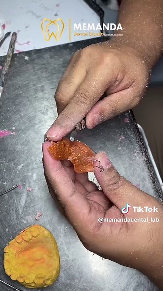 STANDARD HAWLEY RETAINER 🦷✨ Book your retainer with us now 😁 #memandadentalstudio #lovelikeyoursmile #hawleyretainer #sentul #malaysia lab denture