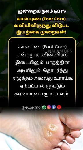 119 reactions · 18 shares | Painful foot corn disturbing your walk?  Don’t worry, you can control it naturally! Warm water soak, turmeric-castor oil paste, and proper food habits can reduce pain and soften the skin. Try these natural remedies today and feel the difference. #FootCornRelief, #NaturalRemedies, #FootCareTips, #HomeRemedy, #HealthyLiving, #PainReliefNaturally, #NalamTips | Nalam Tips | Facebook