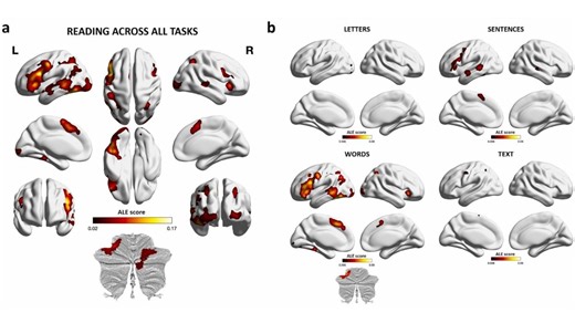 What Happens in Your Brain When You Read? New Study Maps the Reading Mind