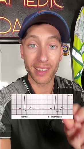 ST Depression on 12 Lead EKG | EMT/PARAMEDIC | The Paramedic Coach #Shorts