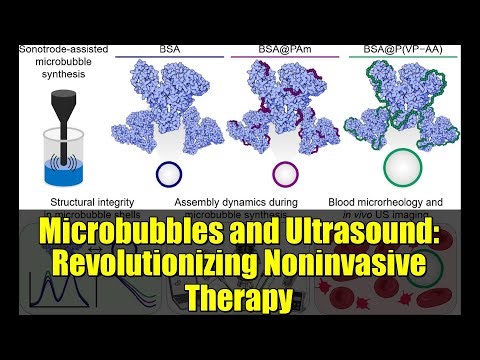 Microbubbles and Ultrasound: Revolutionizing Noninvasive Therapy